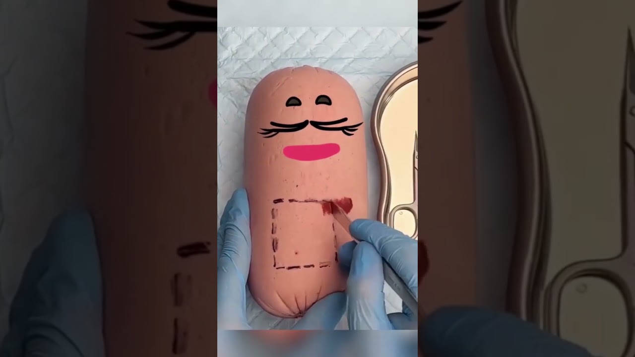 Surgery of hotdogs 