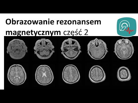 Wideo: Komputerowe Obrazowanie Medyczne I Ramy Hemodynamiczne Do Analizy Funkcjonalnej I Oceny Struktur Sercowo-naczyniowych