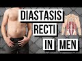 DIASTASIS RECTI IN MEN Over 35 (FIX YOUR BELLY BULGE!)