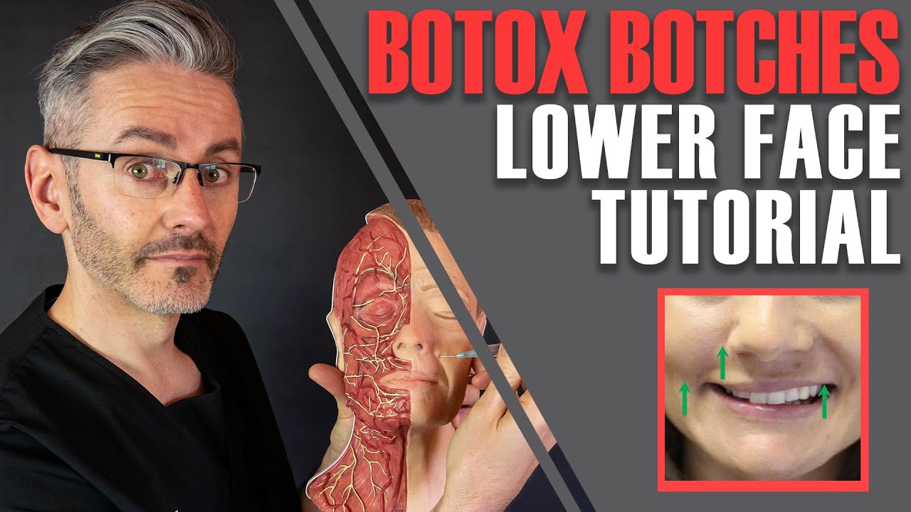 ADVANCED BOTOX ANATOMY: How to avoid nasty lower-face side effects [Aesthetics Mastery Show]