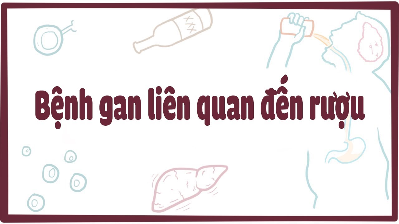 Bệnh gan liên quan đến rượu - YouTube