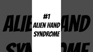 What Is Alien Hand Syndrome..? 2 Facts 1 Fake MEDICAL QUIZ #10 - Psychiatry