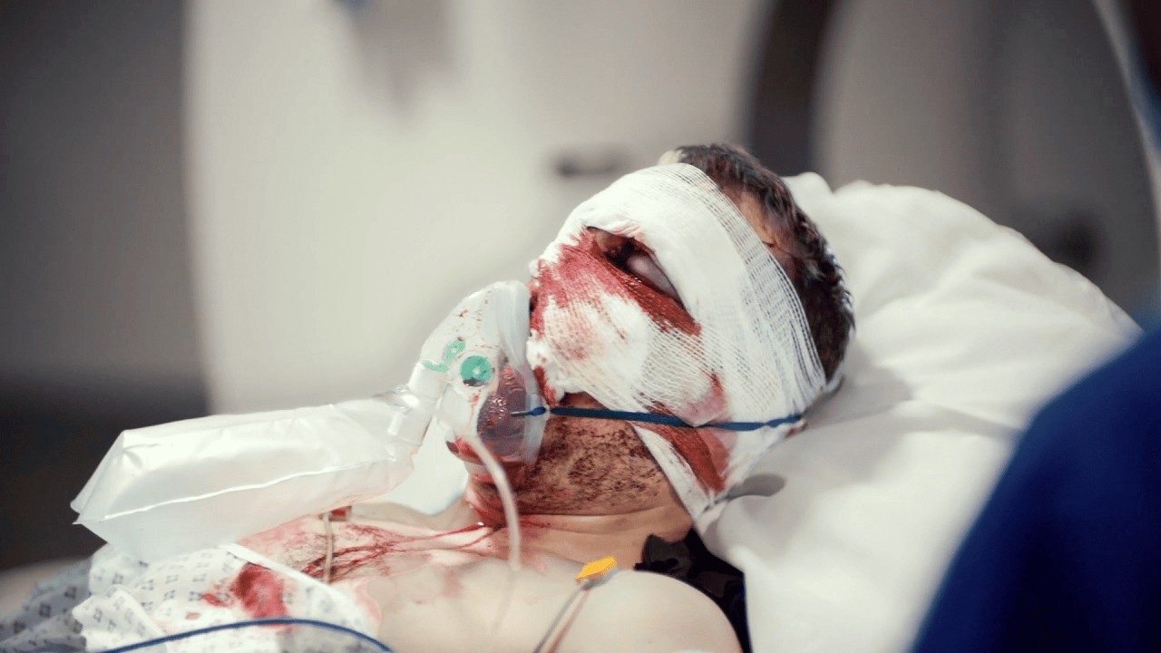 Man Sliced Open By 100kg of Metal | 999 Critical Condition Full Episode S4 E1