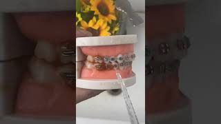 Water Flosser Mega DEAL Get your FREE wellness tracker, trusted by 10,000+ health gurus! 🌿 Link i