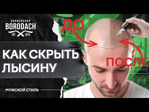 Как скрыть лысину? | Трихопигментация - татуировка волос | Волосы гуще залысины