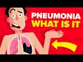 Pneumonia - Explained