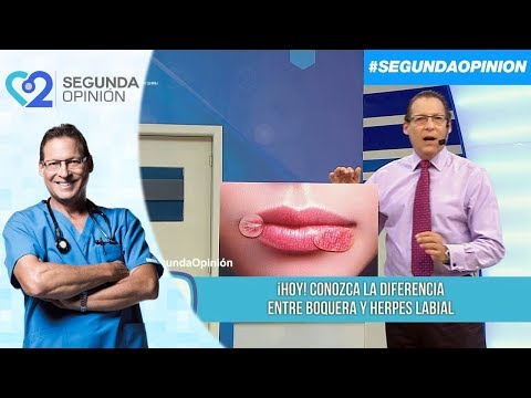 Vídeo: Diferencia Entre úlcera Y Herpes Labial