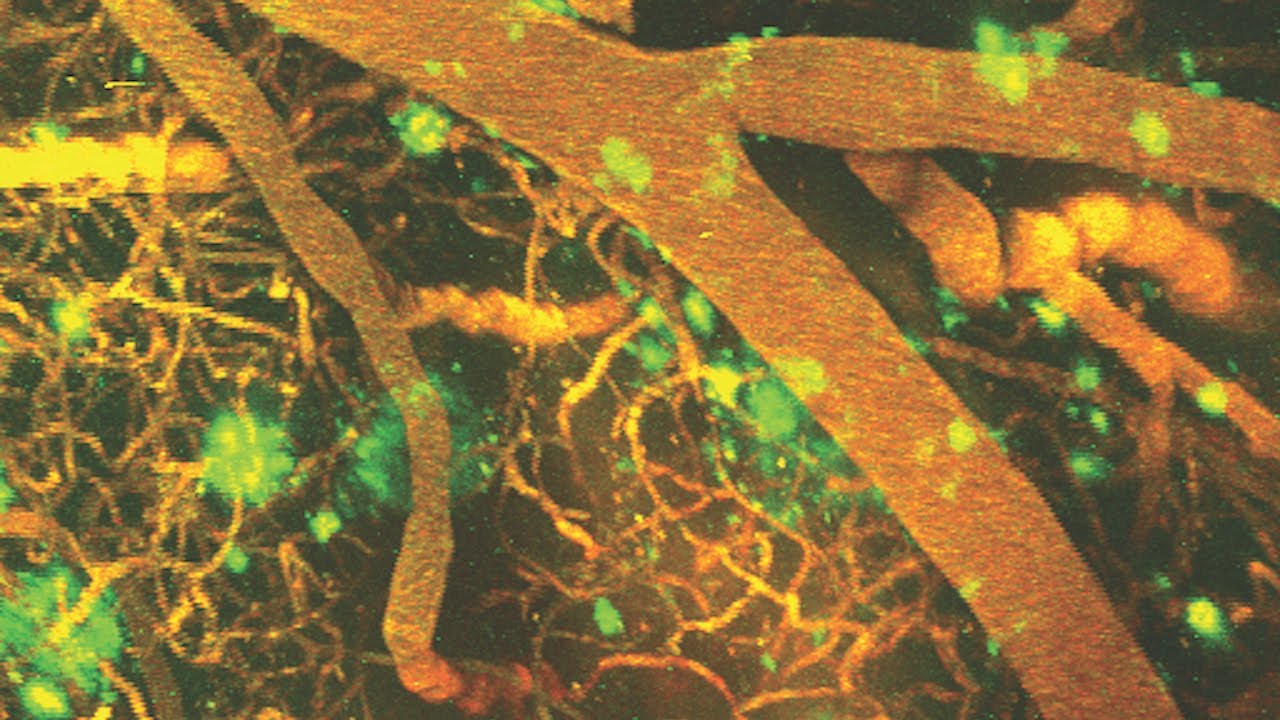 Exploring the link between blood flow and disease using advanced microscopy