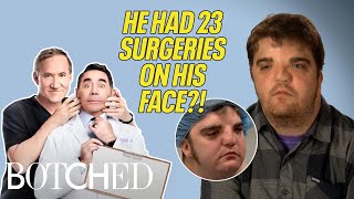 Nate Had $2 MILLION Worth of Surgery for His Facial Difference (Before & After) | Botched | E!