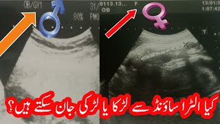 Ultra sound se kesy dekhy k ladka he ya ladki | How to know baby boy or girl in altra sound reports