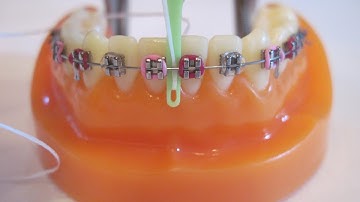 How to floss your posterior teeth using the flossfish.