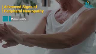 Neuropathie Diabétique Symptômes, Risques Et Prévention Dr. Gurucharan Adoor Apollo Hospitals