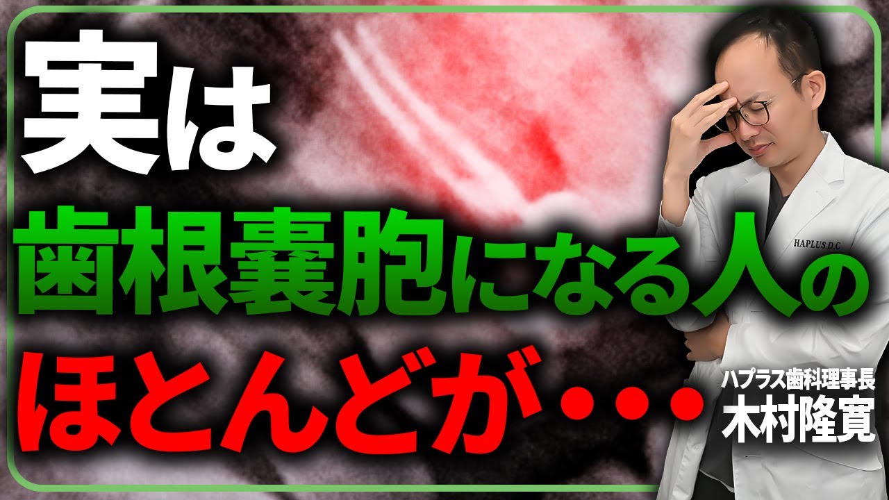 歯根嚢胞になりやすい人の特徴とは？現役歯科医が診療の中で感じた傾向と実際の論文含めてご紹介させていただきます
