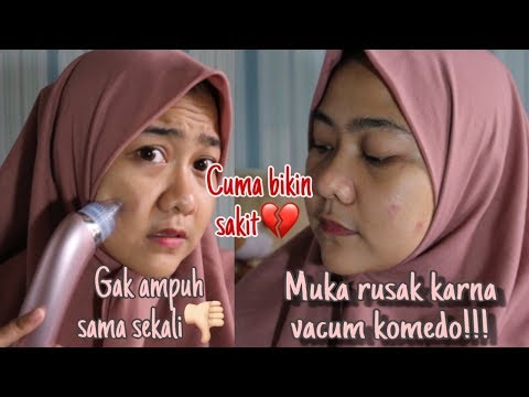 Video: Vakum Blackhead: Cara Penggunaan, Manfaat, Risiko, Lebih Banyak