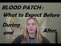 Blood Patch: What to Expect Before, During, and After!