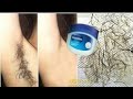 In 5 Minutes, Remove Unwanted Armpit Hair Permanently, Unwanted Hair Will Never Grow Back ll NGWorld