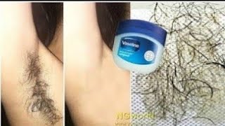 In 5 Minutes, Remove Unwanted Armpit Hair Permanently, Unwanted Hair Will Never Grow Back ll NGWorld In 5 Minutes, Remove Unwanted Armpit Hair Permanently, Unwanted Hair Will Never Grow Back ll NGWorld