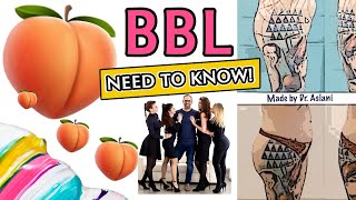 Famous Things You NEED TO KNOW About BBL | Brazilian Butt Lift | Dr Aslani Profile