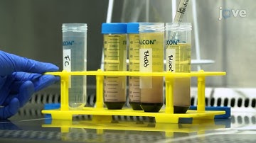 Aortic Valve Calcification Investigating by Feeder Cells | Protocol Preview