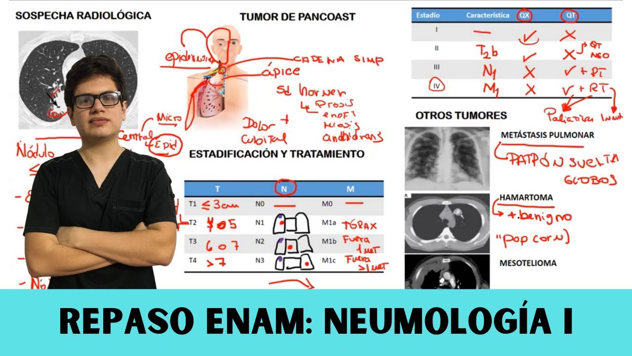 Repaso ENAM 02: Neumología (EPOC, EPID, CÁNCER)