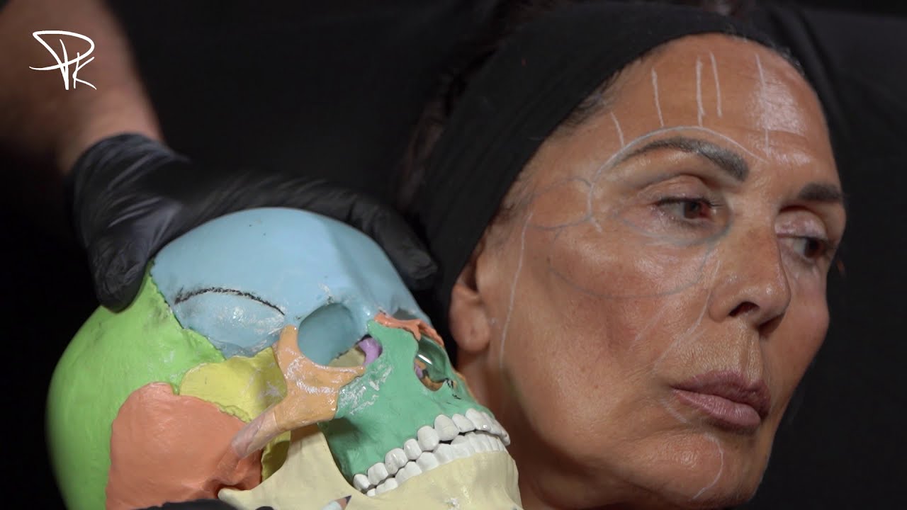 Le rajeunissement facial : Technique et injections (Point théorique / Anatomie graisseuse du visage)