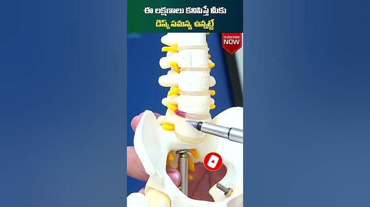 డిస్క్ సమస్య లక్షణాలు | Symptoms of Disc Problems in Back | Socialpost Health | #shorts #healthtips