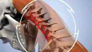 Chiropractic Patient Education Animation