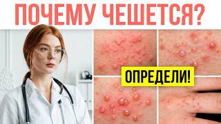 ITCHY SMALL RASH ON THE BODY | What to do about a body rash