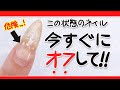 【ネイル注意喚起】この状態のネイルは今すぐオフしてください。浮いてるジェルネイルはグリーンネイルの原因に…