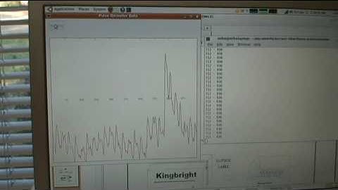DIY Arduino based Pulse Oximeter (part 1 of 2)