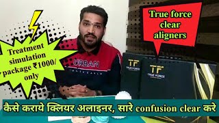 कैसे कराये clear aligner treatment | Treatment simulation package True force clear aligner