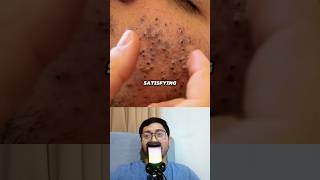 KOMEDO bisa sampe GINI ⁉️🤔 Coba pake ini #faktakesehatan #faktaunik #drbimo