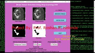 Detection Of Brain Tumor Using Deep Learning CNN Python Project With Source Code Brain Tumor Detect