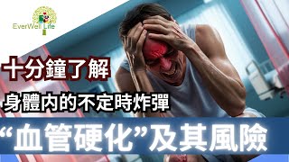 什么是血管硬化？症状、原因及预防方法！