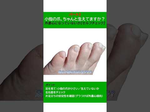 小指の爪がない人 O脚 “老化の赤信号” パート2