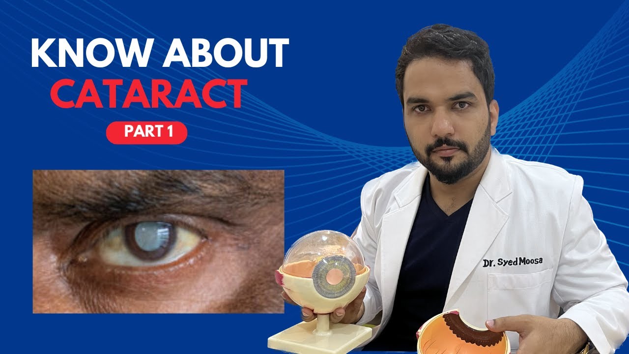 Know about Cataract Tamil Dr. Syed Moosa Eye Doctor YouTube