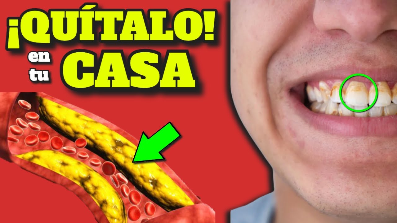 �TEN�S CANSANCIO EXTREMO y FATIGA CRONICA? �Mira tus DIENTES!