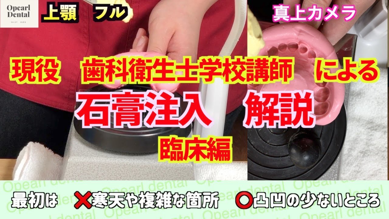【石膏】臨床編　　今の流れ,注入,はずし方,チェックポイント（←おまけ）