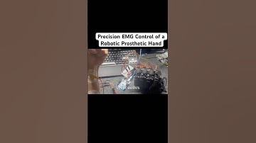 Precision EMG Control of a Robotic Prosthetic Hand