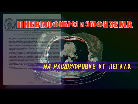 ПНЕВМОФИБРОЗ после ковида и ЭМФИЗЕМА легких на РАСШИФРОВКЕ КТ легких