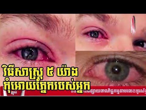 វិធីសាស្រ្ត​ ៥ យ៉ាងដើម្បីជៀសវាងកុំអោយភ្នែករបស់អ្នកក្រហម ឫឡើងបាយ| Red Eye Protection