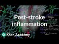 Post stroke inflammation | Circulatory System and Disease | NCLEX-RN | Khan Academy