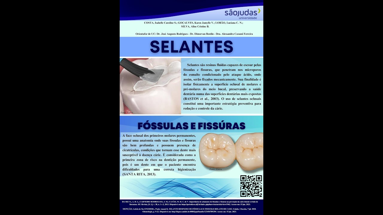 Selante resinoso para fóssulas e fissuras
