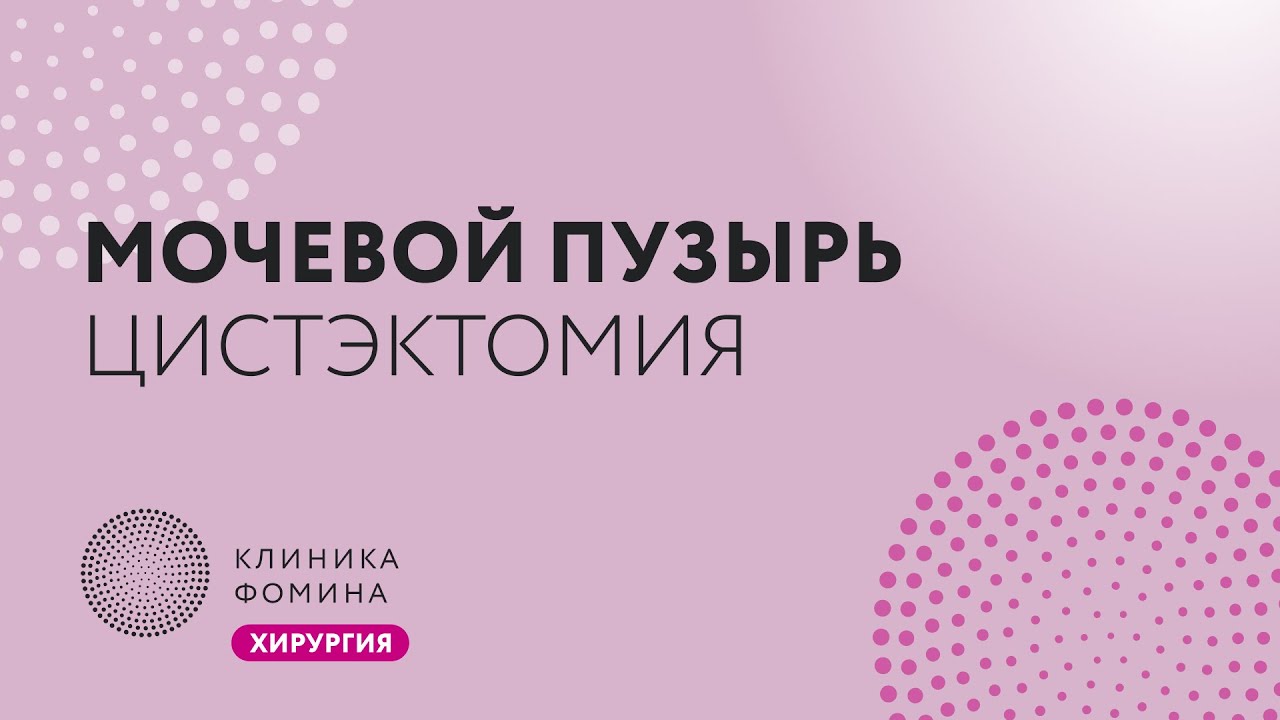 рак мочевого пузыря: радикальная цистэктомия / цистпростатэктомия ...