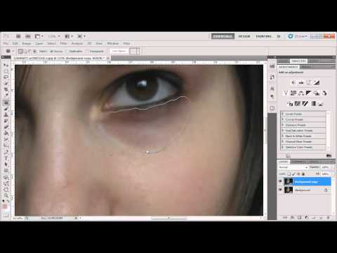 In this tutorial i will show you how to remove dark circles under eyes photoshop. just take the "patch" tool, select area and patch it out. hope ...