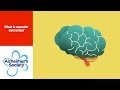 What is vascular dementia