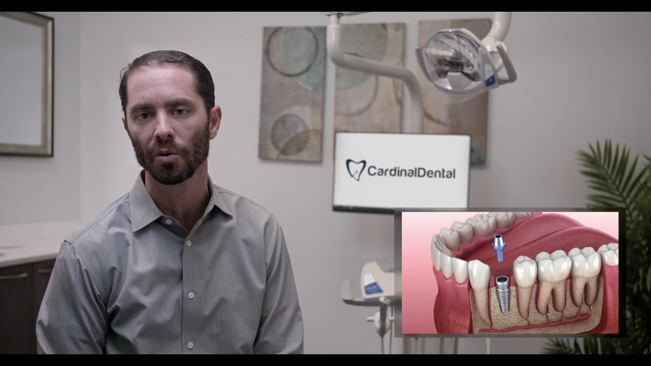Cardinal Dental: Are You a Candidate For a Dental Implant? | La Mesa, CA