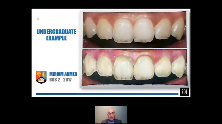 Aesthetic Restorative Dentistry Part 1  |  Anterior teeth Dr l Mackenzie
