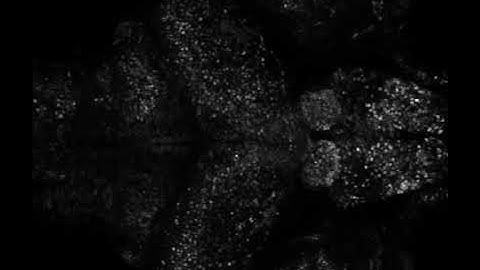 Whole-brain imaging of neuronal activity in Tg(elavl3:H2B-GCaMP6s) larval zebrafish. Single plan