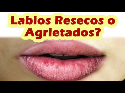 Vídeo: Solo Necesitas 30 Segundos Para Hacer Desaparecer Los Labios Agrietados Y Agrietados